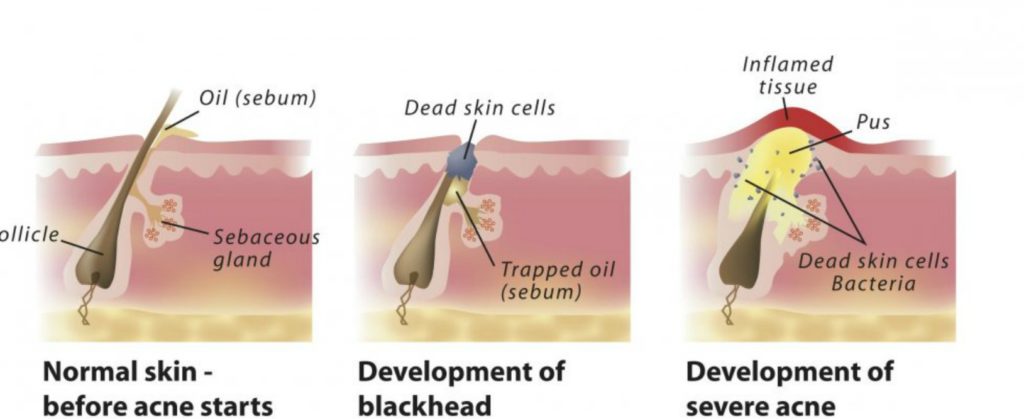 Fiziologija masne kože