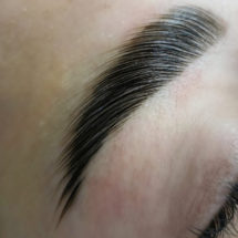brow lift (1) (1)
