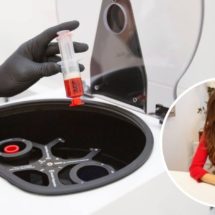 estetska-ginekologija-split (1)