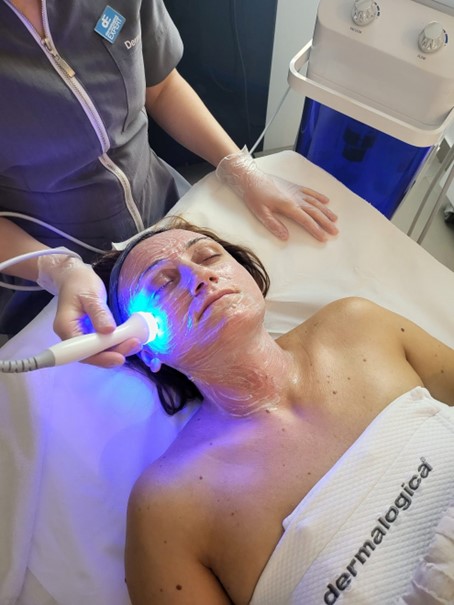 microneedling