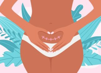 carski porod menstruacija