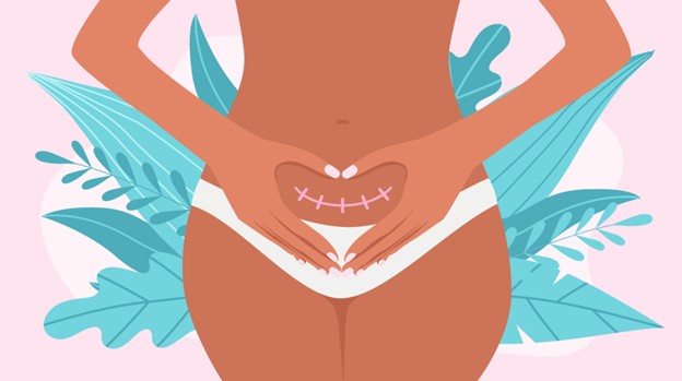 carski porod menstruacija