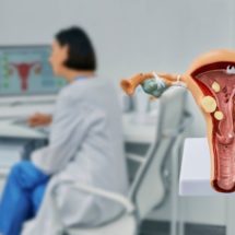 Bakterijska vaginoza