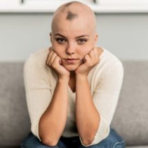 alopecija