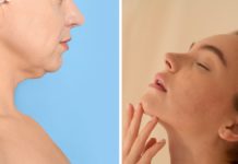 Muči vas podbradak? Riješite ga se uz ovih 5 jednostavnih trikova podbradak
