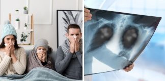 Komplikacije gripe